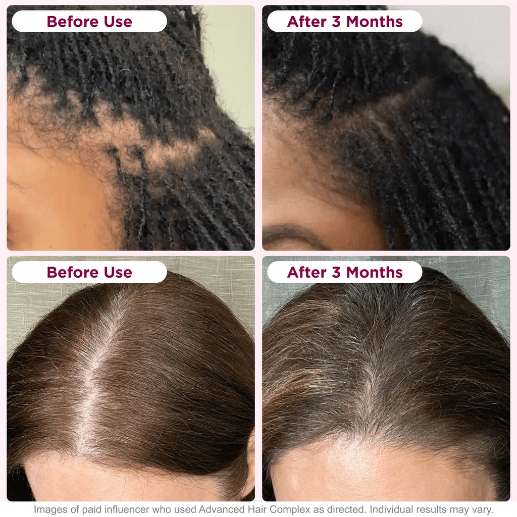 Biotin Hair Growth Supplement 30 Capsules B915