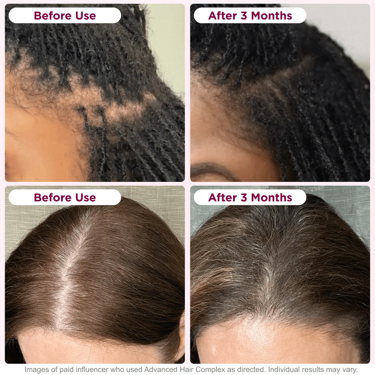 Biotin Hair Growth Supplement 30 Capsules B915